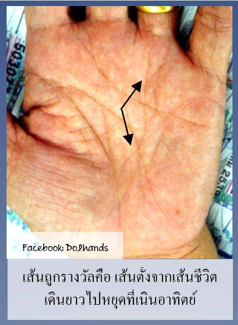 19601150_721393088007636_8892003617263845357_n